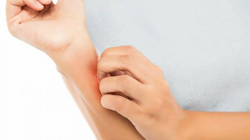 Apış Arası Kaşıntısı Belirtileri ve Tedavisi